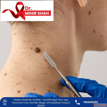 Highly Experienced Head and Neck Cancer Surgeon in Ahmedabad Dr Mihir Shah