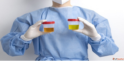 Book Urine Culture Sensitivity Test Online - Max Lab