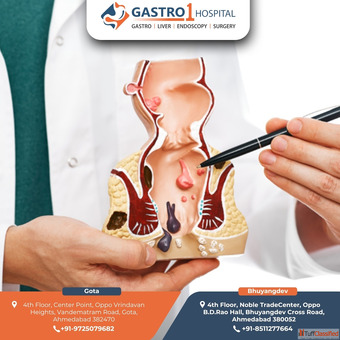 Gastro1 Hospital - Piles Treatment in Ahmedabad with Advanced Laser Surgery