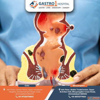 Dr. Ruchir Patel - Best Fissure Doctor in Ahmedabad for Trusted Recovery