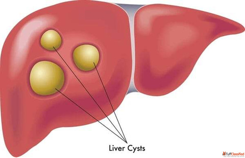 Best Pancreatic Surgeon in Ahmedabad for Advanced Surgical Care