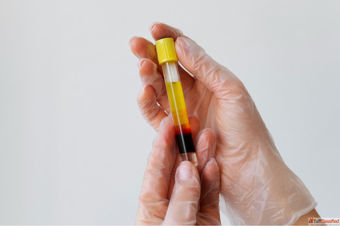 Best Pain Clinic in Kolkata for PRP Therapy Treatment