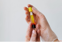 Best Pain Clinic in Kolkata for PRP Therapy Treatment