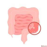 Advanced Minimally Invasive Surgery in Ahmedabad India Dr. V...