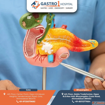 Gastro1 Hospital - Gallbladder Stone Treatment in Ahmedabad with Care and Comfort