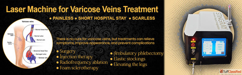 Laser Machine For Varicose Veins Treatment