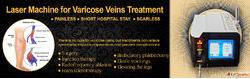 Laser Machine For Varicose Veins Treatment
