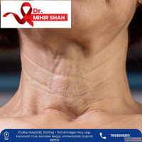 Senior Specialist Head and Neck Cancer Surgeon in Ahmedabad ...