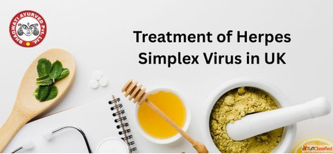 Treatment of Herpes Simplex Virus in UK