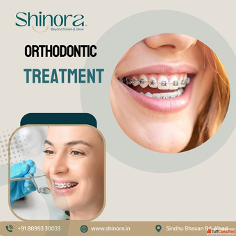 Orthodontic Treatment in Ahmedabad for Straight Confident Smiles - Shinora Clinic