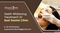 Explore Best Teeth Whitening In Panchsheel Park For Dazzling...