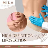 Best High Definition Liposuction Surgery in Ahmedabad - Mila...