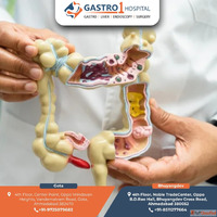 Experienced Appendix Doctor in Ahmedabad with Advance Treatm...