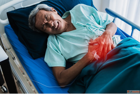 Kidney Stone Surgery in Gorakhpur