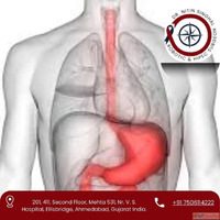 Specialist Stomach Cancer Surgeon in Ahmedabad - Dr. Nitin S...