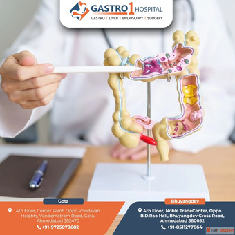 Best IBS Treatment in Ahmedabad for Smooth Recovery - Gastro1 hospital
