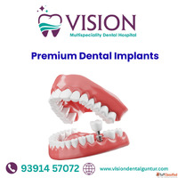 Premium Dental implants in Guntur - Vision multi speciality ...