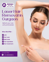 Laser Hair Removal in Gurgaon