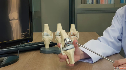 Orthopedic Specialist Hyderabad Dr PeReddy Ortho