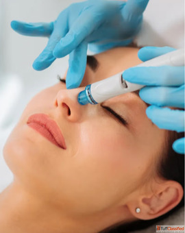 Best Hydrafacial Treatment in Delhi Derma Puritys
