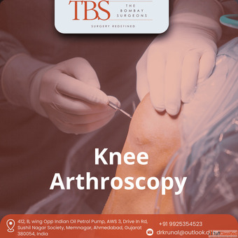 Advanced Knee Arthroscopy Treatment in Ahmedabad Dr. Krunal Soni