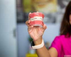 Transform Your Smile - Smile Designing in Mumbai by Smile Ag...