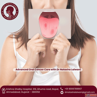 Professional Guidance by Best Oral Cancer Surgeon Ahmedabad - Dr natasha lalwani