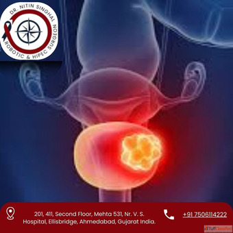 Advanced Bladder Cancer Treatment in Ahmedabad - Dr. Nitin Singhal