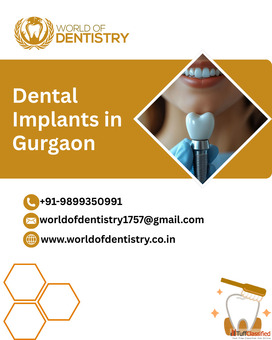 Dental Implants in Gurgaon - Safe Painless Long-Lasting Solutions at World of Dentistry