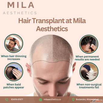 Best Hair Transplant in Ahmedabad with Mila Aesthetics