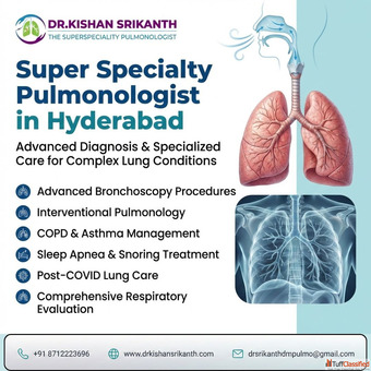 Super Specialty Pulmonologist in Hyderabad