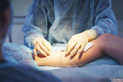 Experienced Varicose Veins Doctor