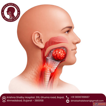 Professional Laryngeal Cancer Surgeon in Ahmedabad - Dr Natasha Lalwani