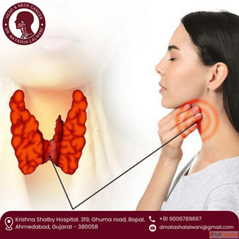 Leading Thyroid Cancer Care Surgeon in Ahmedabad - Dr natasha lalwani