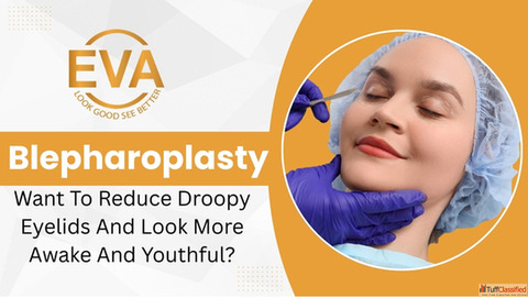 Delhi Upper Eyelid Surgery Blepharoplasty Procedure Cost Guide