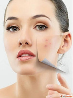 Consult the Best Dermatologist in Lucknow Advanced Skin Care