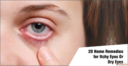 20 Home Remedies for Itchy Eyes Or Dry Eyes