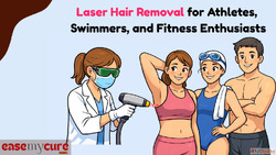 Laser Hair Removal for Athletes Swimmers and Fitness Enthusi...