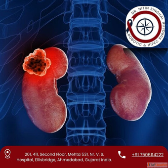 Partial Nephrectomy Surgeon in Ahmedabad - Dr. Nitin Singhal