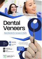 Best Dentist for Veneers in Delhi