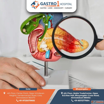 Acute Pancreatitis Treatment in Ahmedabad with Advanced Trusted Care
