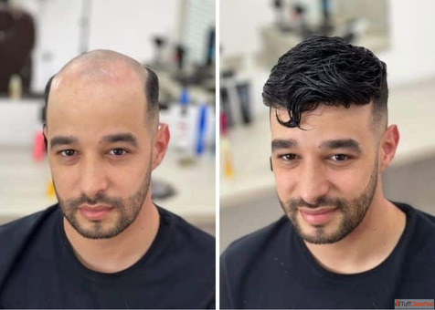 Affordable Hair Pieces for Men - Natural Look at the Right Price