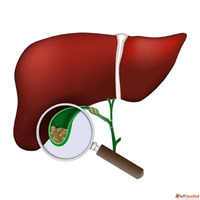 Dr. Vishal Soni Advanced Minimally Invasive Surgery in Ahmed...