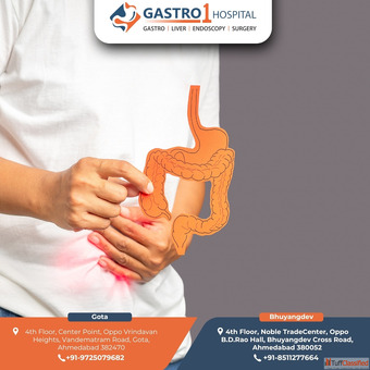 Best Colon Cancer Treatment in Ahmedabad for Advanced Care Real Results