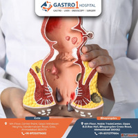 Best Piles Treatment in Ahmedabad with Latest Laser Technolo...