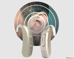 Hearing Aid Solution in Rohini Saimo Istok - Digital Hearing...