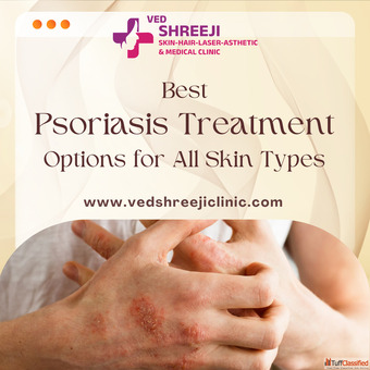 Best Psoriasis Treatment Options for All Skin Types