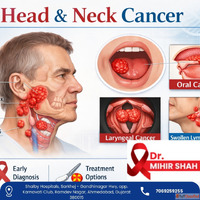 Consult Head and Neck Cancer Surgeon in Ahmedabad - Dr. Mihi...