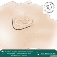 Best ENT Doctor for Facial Nerve Decompression in Ahmedabad ...