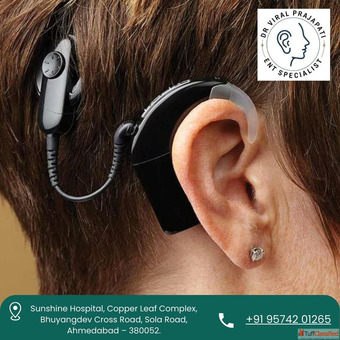 Advanced Cochlear Implant Surgeon in Ahmedabad - Dr. Viral Prajapati